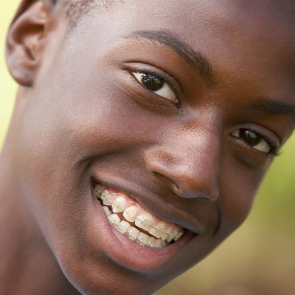 Gold Braces Southaven & Tupelo Gold Braces Southaven & Tupelo
